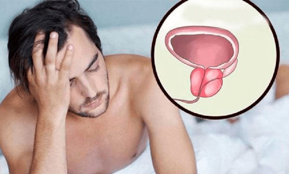 Symptome einer Prostatitis